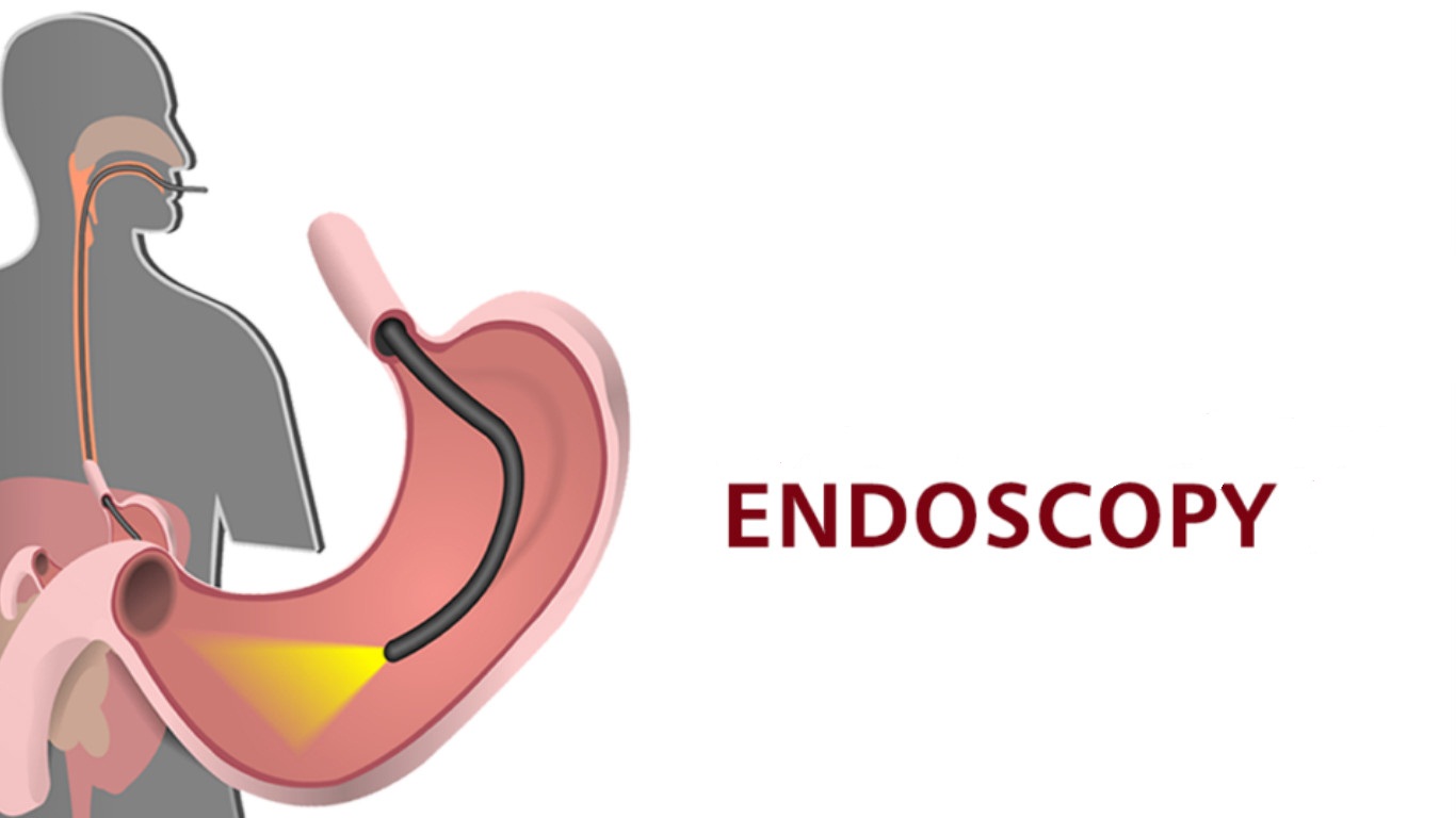 Endoscopy Procedure Colonoscopy Step by step Recovery Coimbatore